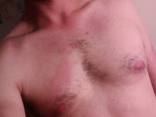 not really much to say. just a chest shot.