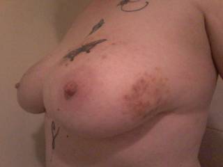 Sally was paddled and restrained at the kinky party... this was the resulting marks!