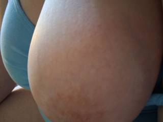 would you make me cover it up or try to get the other one out?