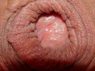 Just a real up close shot of my puckered foreskin waiting to be nibbled