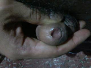 hole open ureter