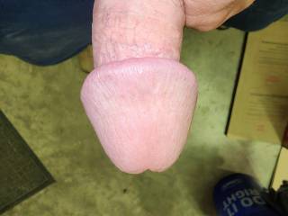 All swollen and no place to stick it