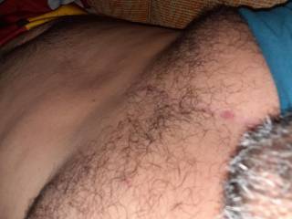 My body scars and all