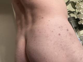 My bum