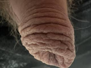 Wrinkled foreskin