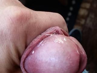 Needs attention so bad