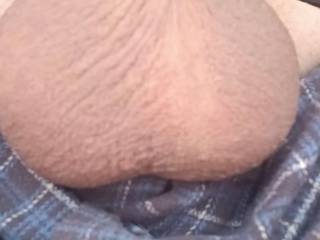 Morning view of my ball\'s i need some help 😩