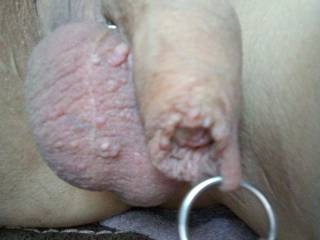 My foreskin with ring