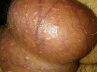 Balls squeezed.