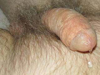 A side & head close up of my erection with my male fluid drops on my skin in late April of 2025. A SX 160 camera was used.