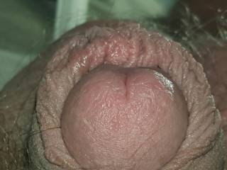 Coax him out from behind the tender foreskin curtain for me? Thoughts or ideas?