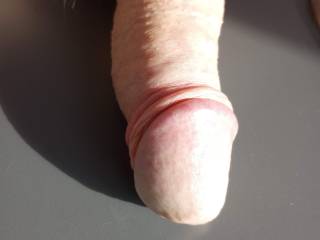 Cockhead with foreskin skinned back.