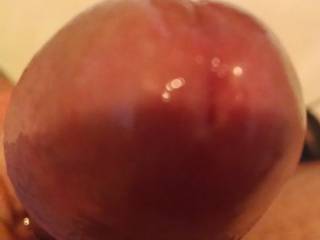 The head is very swollen...I think I\'m gonna to pop!