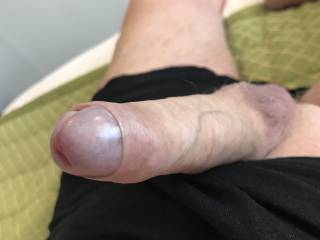 Who wants to push my foreskin back with there Pussy ?