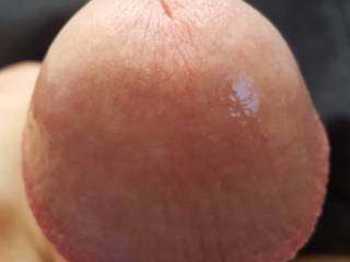 My head
