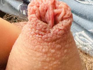 Foreskin