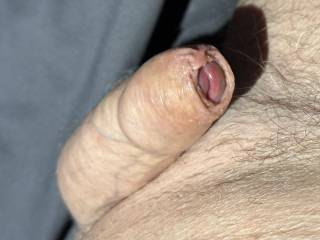 I think it sexy seeing my cockhead just pushing through my foreskin, Do you  ?