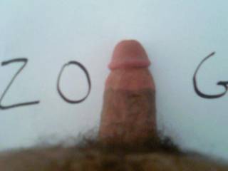 zoig dick