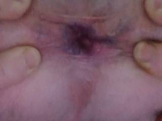 Asshole Opening For Your Pleasure