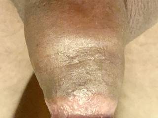 Pumped my dick last night it looks shorter, but man is it nice and thick. A lot of discoloration.