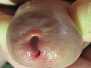 My Peehole
