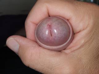 For those who like foreskin